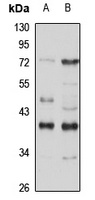 Nmi Rabbit Polyclonal Antibody