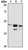 NMUR2 Rabbit Polyclonal Antibody