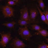 NOB1 Antibody
