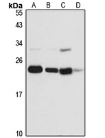NOP16 Antibody