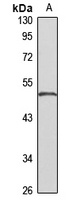 SDR1 Rabbit Polyclonal Antibody