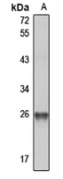 NQO2 Rabbit Polyclonal Antibody