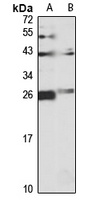 NQO2 Rabbit Polyclonal Antibody