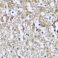 NQO2 Rabbit Polyclonal Antibody
