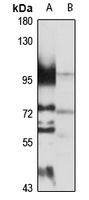 NSUN2 Rabbit Polyclonal Antibody