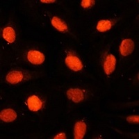 NSUN2 Rabbit Polyclonal Antibody