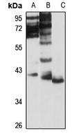 NSUN3 Rabbit Polyclonal Antibody