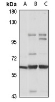 Netrin-G1 Rabbit Polyclonal Antibody