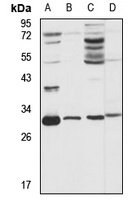 NUBP2 Rabbit Polyclonal Antibody