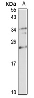 NUDT16 Rabbit Polyclonal Antibody