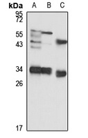 NUDT5 Rabbit Polyclonal Antibody