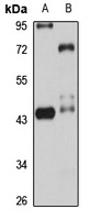 NUPL2 Rabbit Polyclonal Antibody