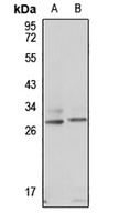 ODF1 Rabbit Polyclonal Antibody