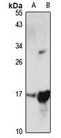 ORMDL3 Rabbit Polyclonal Antibody