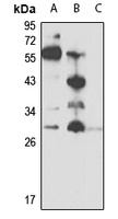 Oncostatin M Antibody