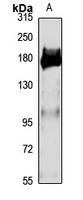 OTUD4 Rabbit Polyclonal Antibody