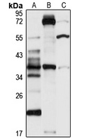 GPR80 Rabbit Polyclonal Antibody