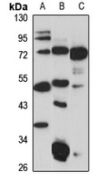 P2X3 Rabbit Polyclonal Antibody