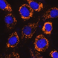 P4HA3 Rabbit Polyclonal Antibody