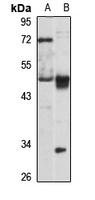 PAFAH alpha Rabbit Polyclonal Antibody