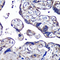 PASK Rabbit Polyclonal Antibody