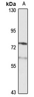 PCSK9 Rabbit Polyclonal Antibody