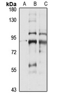 PDE1C Rabbit Polyclonal Antibody