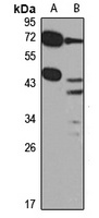 PDGFD Rabbit Polyclonal Antibody