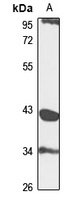 PDGFRL Rabbit Polyclonal Antibody
