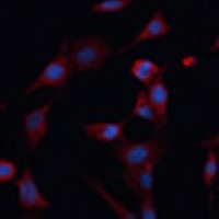PDIA2 Rabbit Polyclonal Antibody