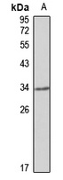 PDLIM3 Rabbit Polyclonal Antibody (ALP)