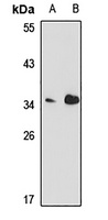 Podoplanin Rabbit Polyclonal Antibody