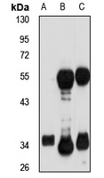 PDXP Rabbit Polyclonal Antibody