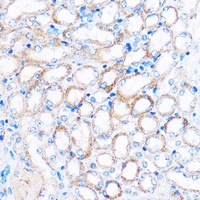 PDXP Rabbit Polyclonal Antibody
