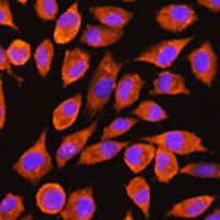 PDXP Rabbit Polyclonal Antibody