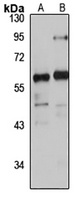 PDZK2 Rabbit Polyclonal Antibody