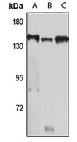 PER1 Rabbit Polyclonal Antibody