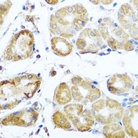 PER1 Rabbit Polyclonal Antibody