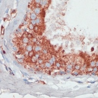 PGK2 Antibody