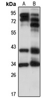 PHF10 Rabbit Polyclonal Antibody