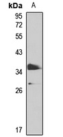 PHF11 Rabbit Polyclonal Antibody