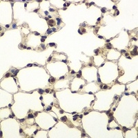 PHF11 Rabbit Polyclonal Antibody
