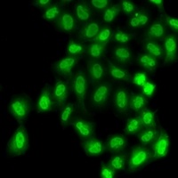 PHF11 Rabbit Polyclonal Antibody