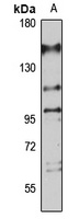 PHF20 Antibody