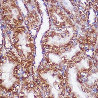 M Rabbit Polyclonal Antibody