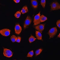M Rabbit Polyclonal Antibody