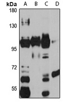 PIGR Rabbit Polyclonal Antibody