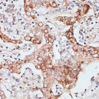 PIGR Rabbit Polyclonal Antibody