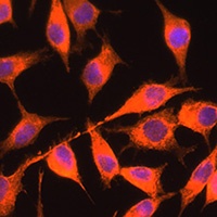 PI-TP alpha Rabbit Polyclonal Antibody