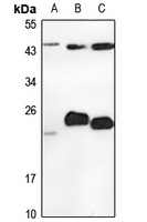 PMVK Rabbit Polyclonal Antibody